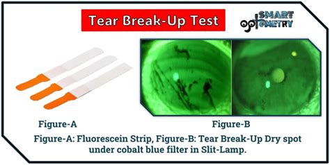 4 tear test|reduced tear break up time.